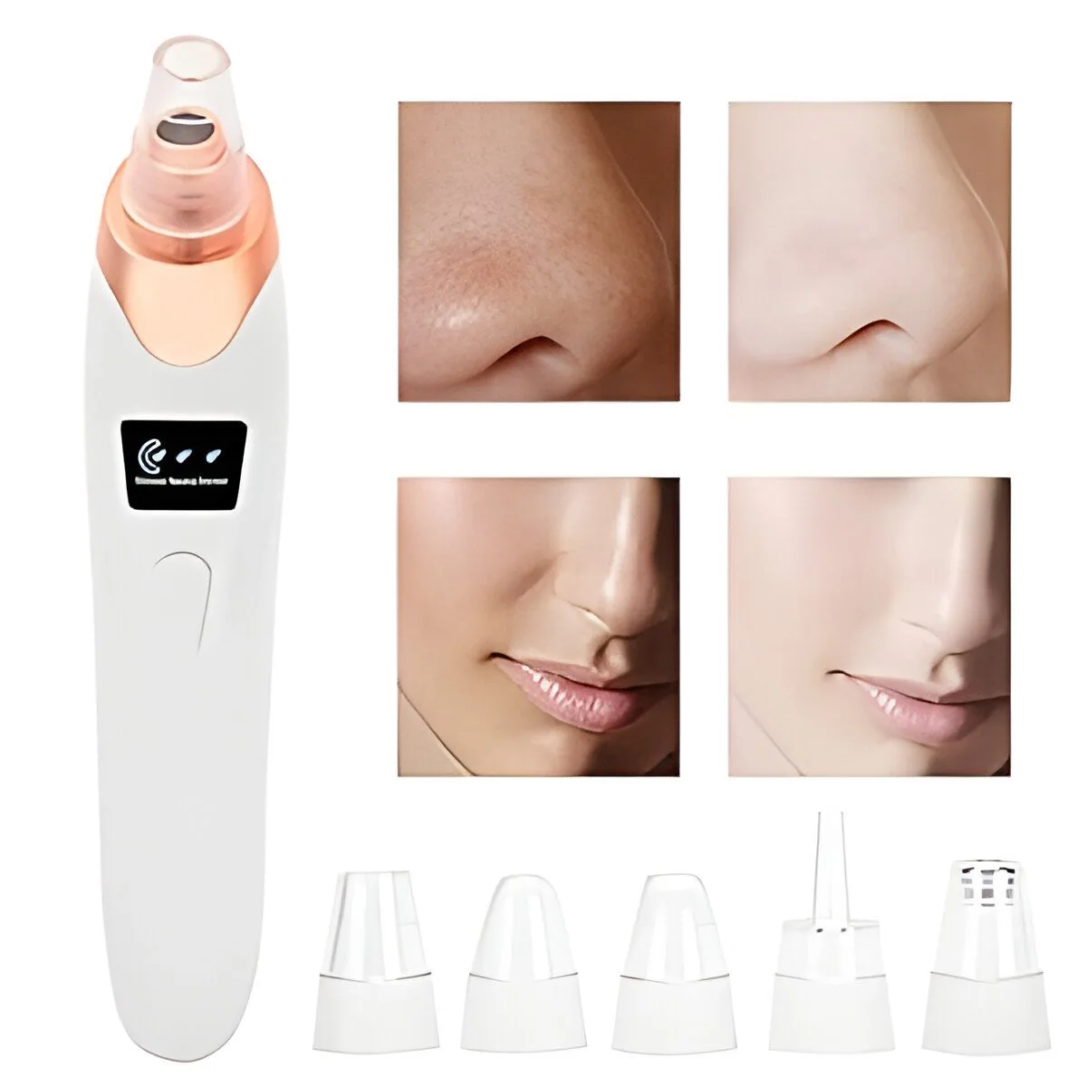 5 in 1 Black head Remover - Rechargeable Blackhead Remover Acne Remover  Vacuum Suction